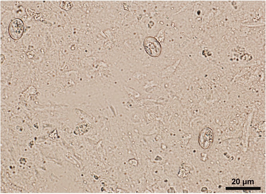 Sarcocystis sporocysts in an intestinal homogenate from a Pennsylvania coyote