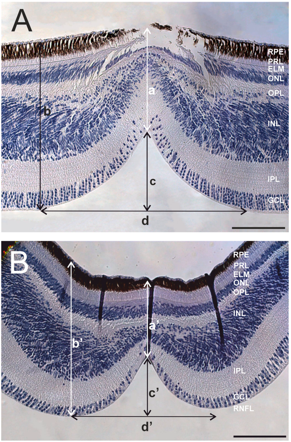 Histological sections of the central and temporal foveae in the common kestrel retina