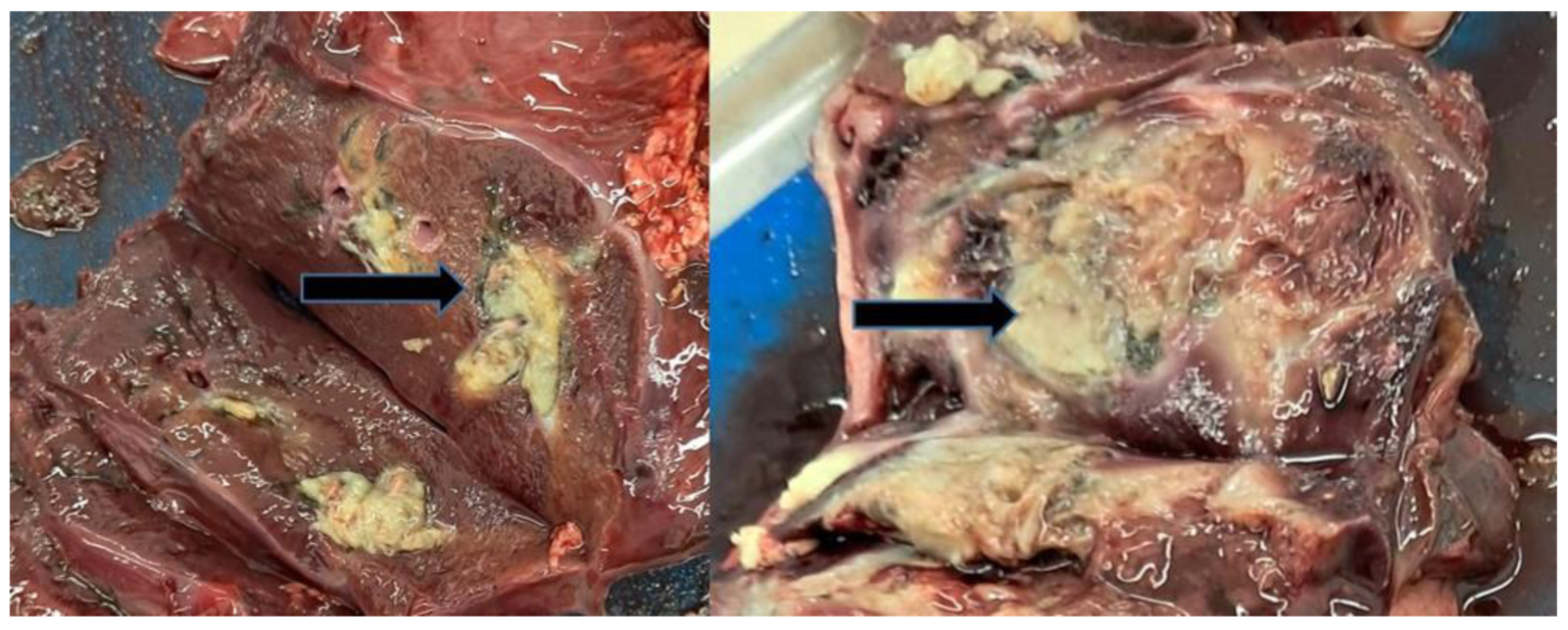 Regenerative nodules in two red deer livers
